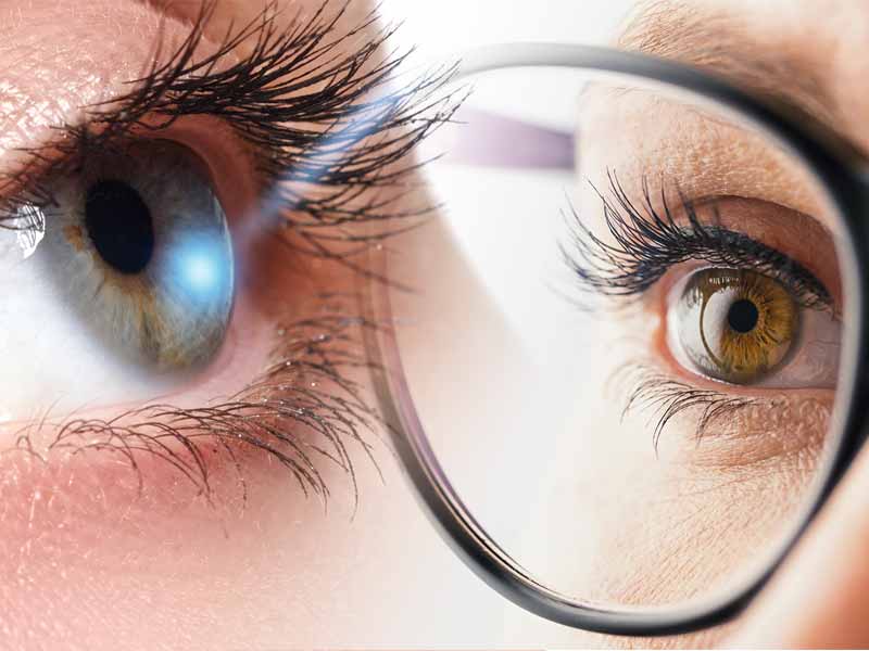 بهترین جراح لیزیک در تهران