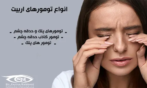 انواع تومور اربیت