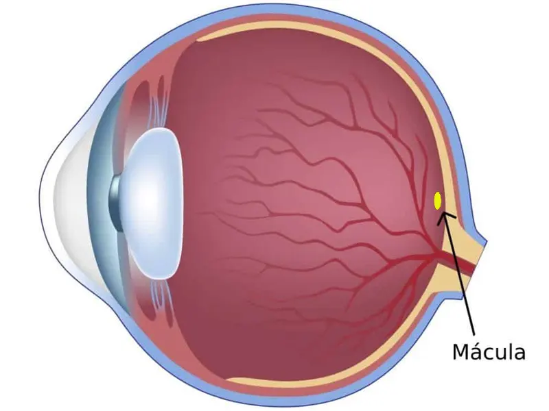 بیماری ماکولای شبکیه چشم